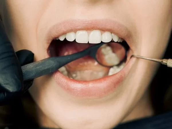 7 Ways to kill tooth pain nerve in 3 seconds permanently